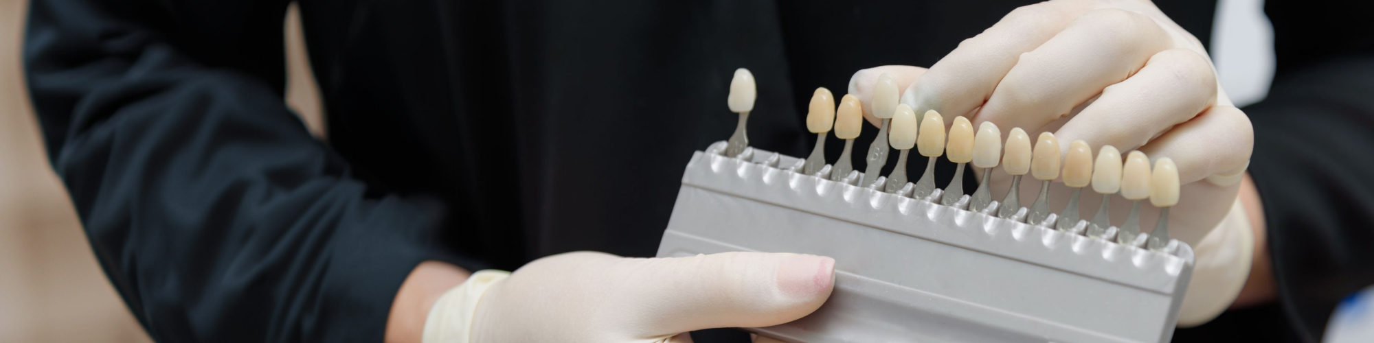Gloved hands holding a teeth shade-matching tool.